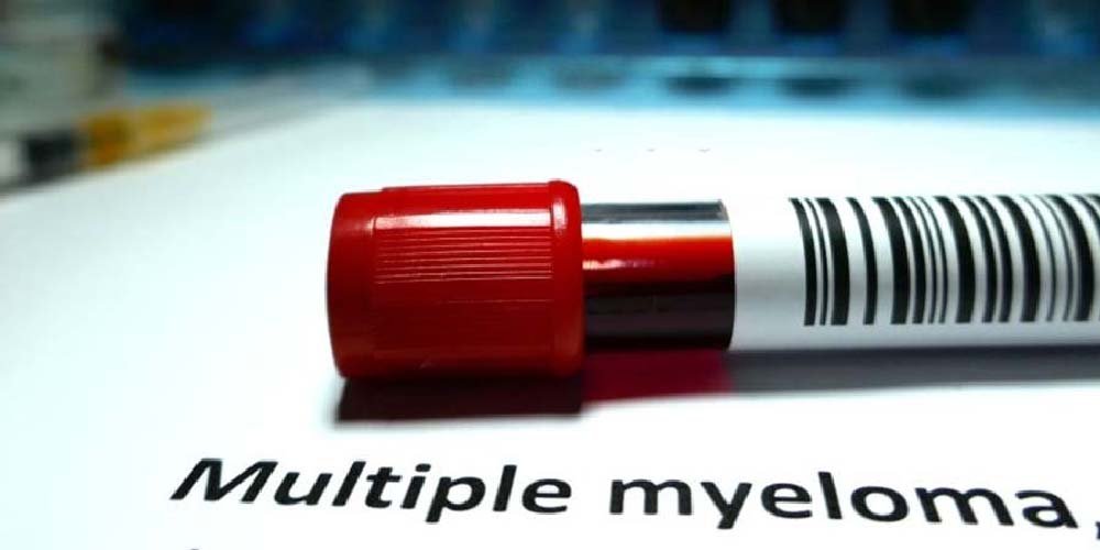 Read more about the article DIAGNOSIS & EVALUATION OF MULTIPLE MYELOMA