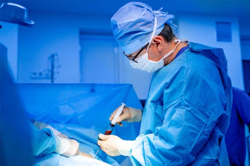 Read more about the article Role of bone marrow transplant in multiple myeloma Bone marrow transplant/ stem cell transplant